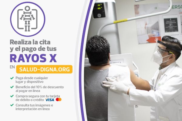 Cuánto cuesta una radiografía en Salud Digna ➜ Precio de los Rayos X