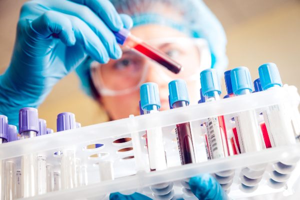 Estudios de Laboratorio Salud Digna ➜ precios, citas y resultados